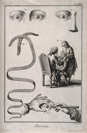 view A sheet showing eye defects, apparatus and an examination. Engraving by Prévost, 1763, after L.-J. Goussier.