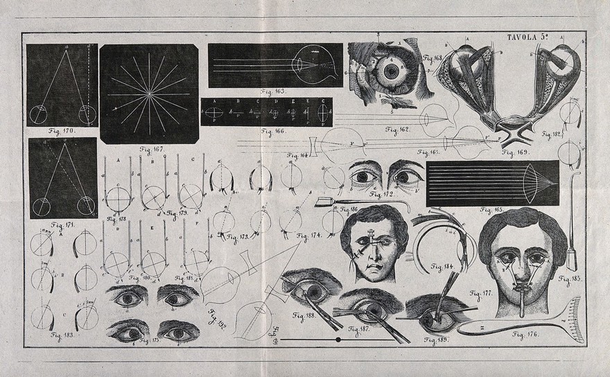 A sheet showing optical instruments, eye examinations, diagrams to show the effect of lenses and diagrams of the eye with a numbered key. Wood engraving.