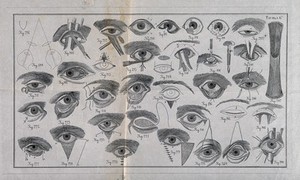 view A sheet of eye examinations and diagrams of the eye with a numbered key. Wood engraving.