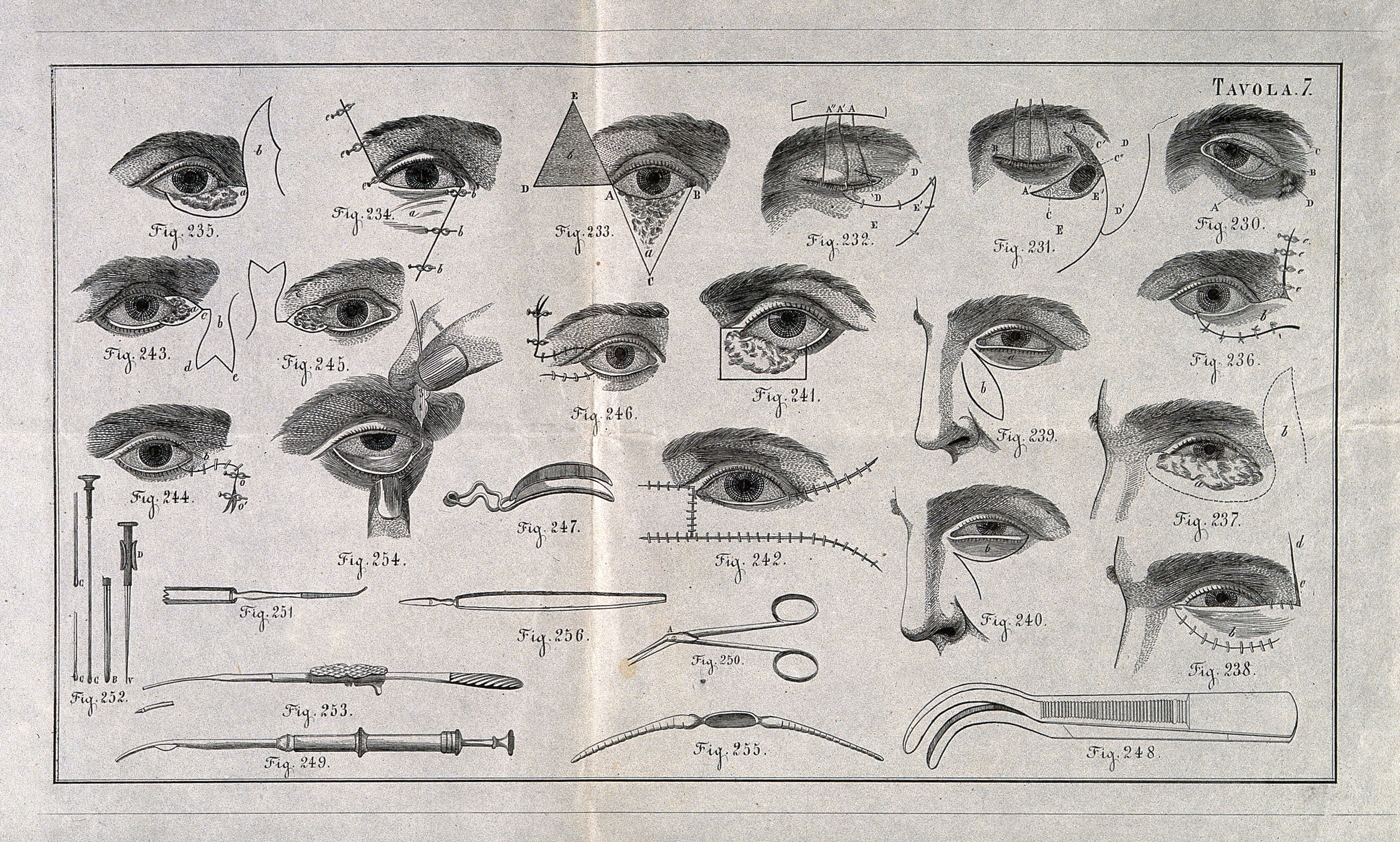 A sheet showing optical instruments, eye examinations, and diagrams of