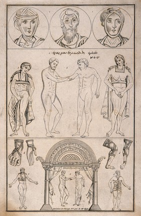 Top, three bandaged heads; centre, a naked surgeon sets the arm of a naked patient both flanked by bandaged women; bottom, bandaged bodies and limbs. Engraving.