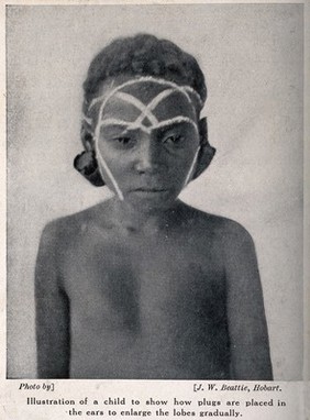 A child with plugs in holes in his earlobes - to gradually increase the size, for ornamental purposes. Halftone after a photograph by J.W. Beattie.