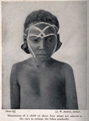 view A child with plugs in holes in his earlobes - to gradually increase the size, for ornamental purposes. Halftone after a photograph by J.W. Beattie.