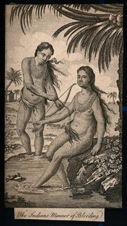 A man bleeding a woman in her arm by using a bow and arrow. Etching.