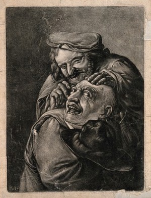 view A malicious itinerant surgeon extracting stones from a grimacing patient's head; symbolising the extraction of 'folly' (insanity). Mezzotint by J. van der Bruggen after D. Teniers.