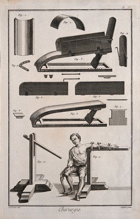 Surgery: an assortment of surgical instruments, including a contraption for complex fractures and a machine for the luxation of dislocated arms. A man is tied with his left arm into the machine. Engraving with etching by Defehrt after L.-J. Goussier.
