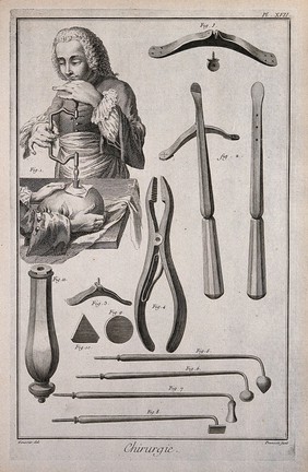 Surgery: above, a skull being trepanned; below, various instruments used in trepanation. Engraving with etching by B.L. Prevost after Louis-Jacques Goussier.