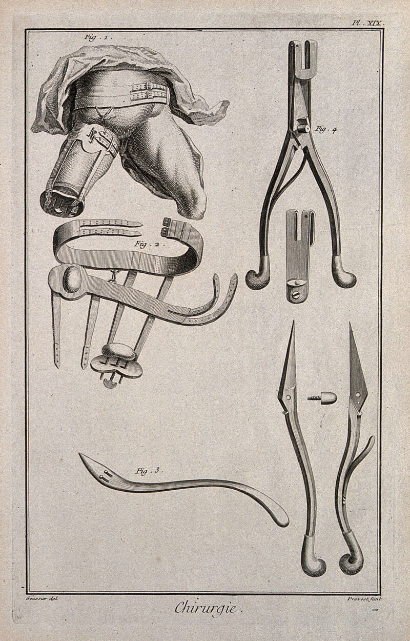 Surgery: instruments for the amputation of limbs, including chisels and needles. Engraving with etching by B.L. Prevost after Louis-Jacques Goussier., by Louis-Jacques Goussier