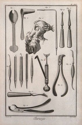 Surgery: instruments for cauterizations. Engraving with etching by A.J. Defehrt after L.J.-Goussier.