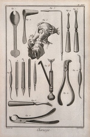 view Surgery: instruments for cauterizations. Engraving with etching by A.J. Defehrt after L.J.-Goussier.