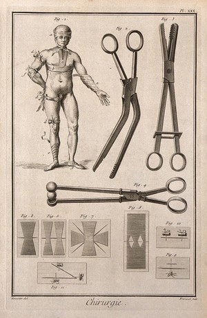 view Surgery, surgical instruments, including bullet forceps and different techniques for sutures. Engraving with etching by B.L. Prevost after L.-J. Goussier.