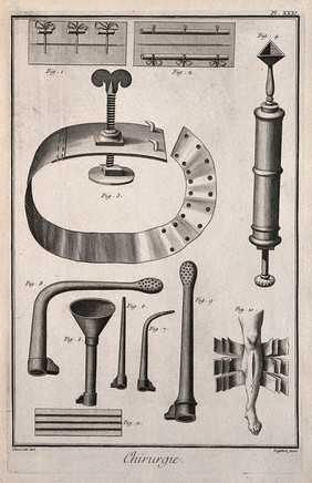 Surgery: surgical instruments, including a tourniquet. Engraving with etching by A.J. Defehrt after L.-J. Goussier.