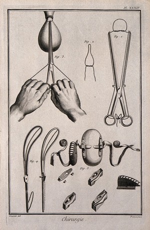view Surgery: surgical instruments for the removal of polyps from the uterus. Engraving with etching by B.L. Prevost after L.-J. Goussier.