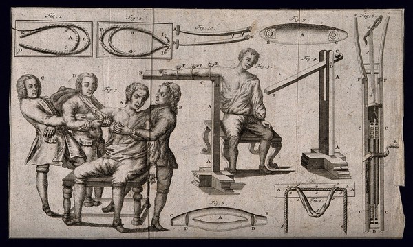 Surgical instruments and patients undergoing treatment.Engraving with etching.