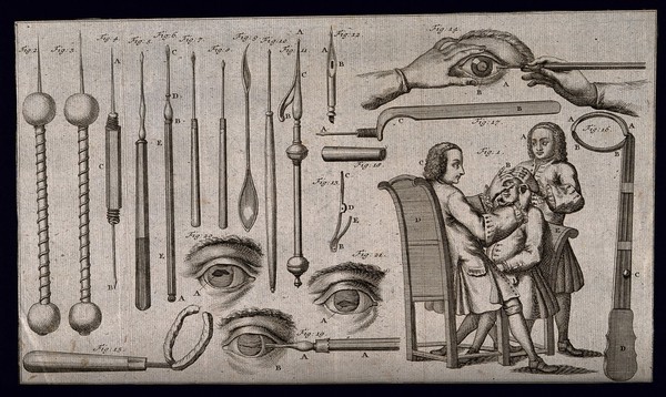 Surgical instruments and patients undergoing treatment. Engraving with etching.