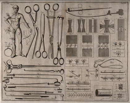 Surgical instruments, including needles and scalpels. Engraving with etching by George Bickham.