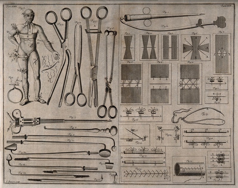 Surgical instruments, including needles and scalpels. Engraving with etching by George Bickham., by George Bickham the Younger