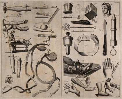 Surgical instruments. Engraving with etching by R. Parr.