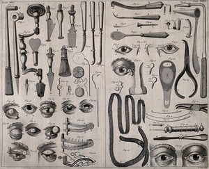 view Surgical instruments. Engraving with etching by R. Parr.