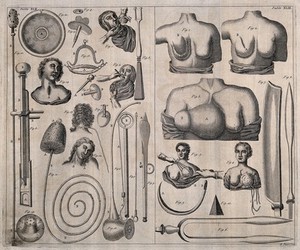 view Surgical instruments and patients with diseases of the breast. Engraving with etching by R. Parr.