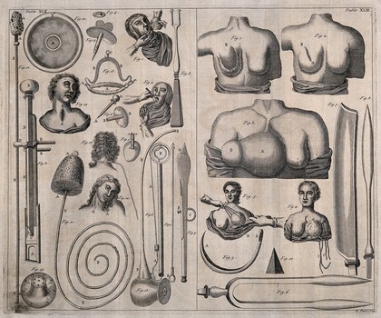 Surgical instruments and patients with diseases of the breast. Engraving with etching by R. Parr.