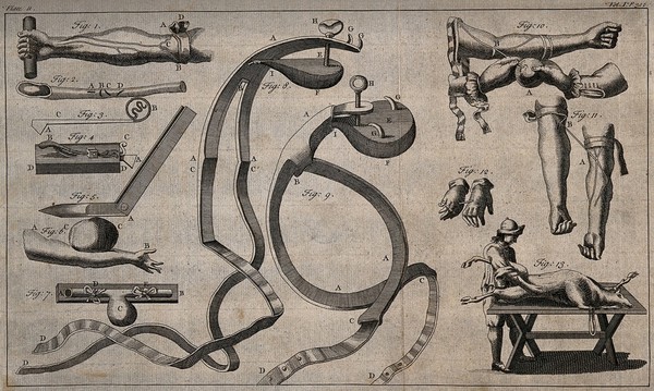 Surgical instruments. Engraving with etching.