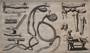 view Surgical instruments. Engraving with etching.