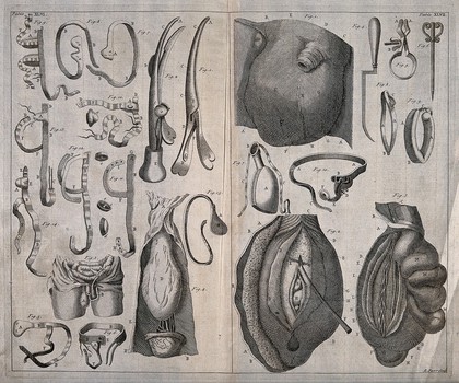 Hernias and surgical instruments for their treatment. Engraving with etching by R. Parr.