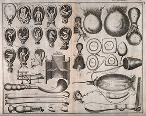 view Left, different methods of examining the uterus; right, uteri with moles and prolapsed uteri. Engraving with etching.