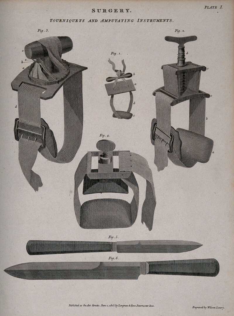 Surgical instruments: tourniquets and amputating instruments. Engraving by Wilson Lowry, 1803., 1June 1803, by Wilson Lowry
