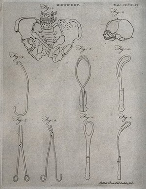 view Surgical instruments for midwifery. Engraving by Andrew Bell.