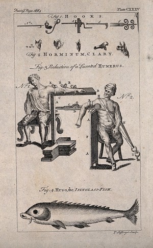 view Above, surgical instruments and apparatus to cure a fractured humerus; below, Huso, the Isinglass fish. Engraving with etching by T. Jefferys.