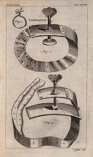 view Surgical instruments: tourniquets. Engraving with etching by T. Jefferys.