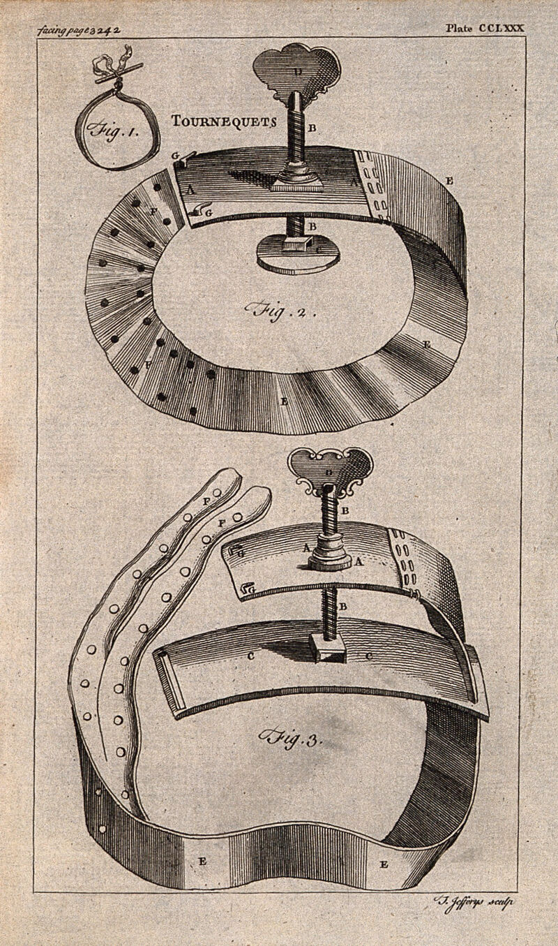 Surgical instruments: tourniquets. Engraving with etching by T. Jefferys., by Thomas Jefferys