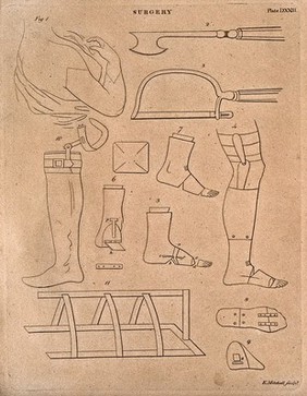 Surgical instruments, including prostheses. Engraving by E. Mitchell.