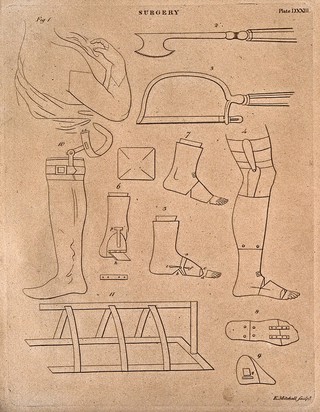 Surgical instruments, including prostheses. Engraving by E. Mitchell.