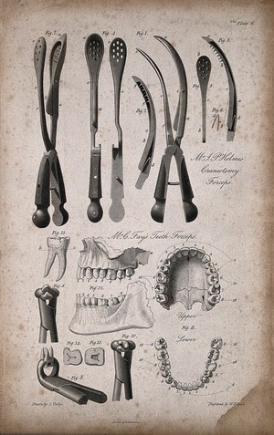 view Midwifery and other instruments, including forceps and pliers. Engraving by W. Kelsall after C. Varley.