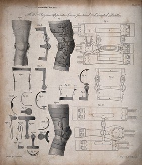 Surgical appliance for the treatment of a fractured and dislocated knee: 25 figures. Engraving by W. Kelsall after J. Clement.