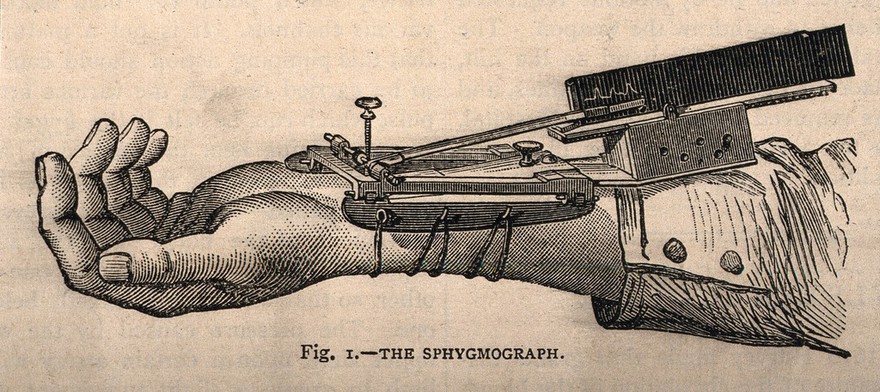 A sphygmograph: an instrument (also known as a 'pulsometer') for recording graphically the features of the pulse and variations in blood pressure. Wood engraving, 1850/1880?.