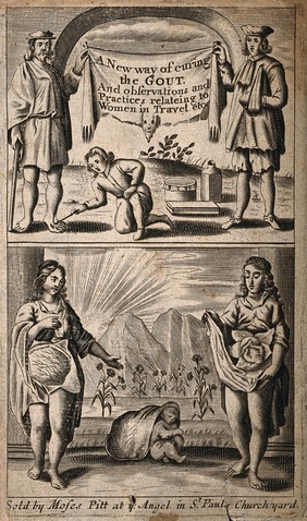 Above, treatment of gout, below, obstetrics. Engraving.