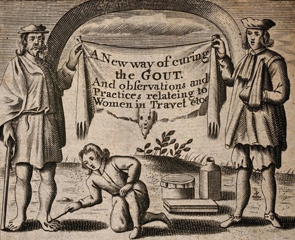 Above, treatment of gout, below, obstetrics. Engraving.