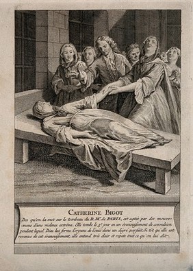 Catherine Bigot, deaf-mute woman lying on the tomb of F. de Paris being miraculously cured. Engraving.