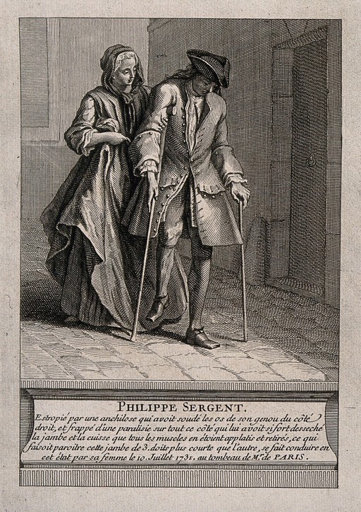 Philippe Sergent, suffering from ankylosis due to deformation of the spine, walking with crutches and aided by a female companion. Engraving.