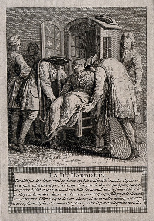 La delle Hardouin, a woman who is paralysed in both legs and has to be transported everywhere. Engraving.