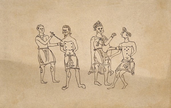 Two surgeons applying the method of cauterisation to clearly defined points on the chests of two male patients, the senior surgeon wears a pointed hat (?). Pen drawing after an Anglo Saxon tenth century manuscript.