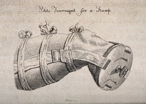 view An amputated leg in a tourniquet supported by a piece of wood that covers the end of the stump. Engraving by J. Beugo.