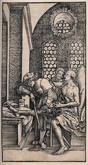 A surgeon amputating a patient's leg with a saw while he is seated and conscious, blood flows to the floor. Woodcut, 1531.