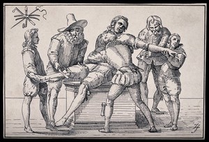 view Two surgeons amputating the leg and arm of the same patient who is being restrained by assistants. Pen drawing after an engraving, 1597.