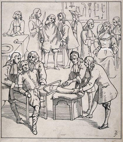 An operating room in a surgery: three patients are undergoing operations. Pen drawing by Z.S. after an engraving, 1690.