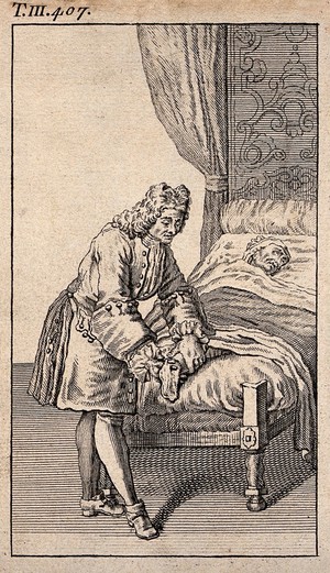 view A surgeon dressing the stump of a patient's recently amputated leg. Engraving, 1738.